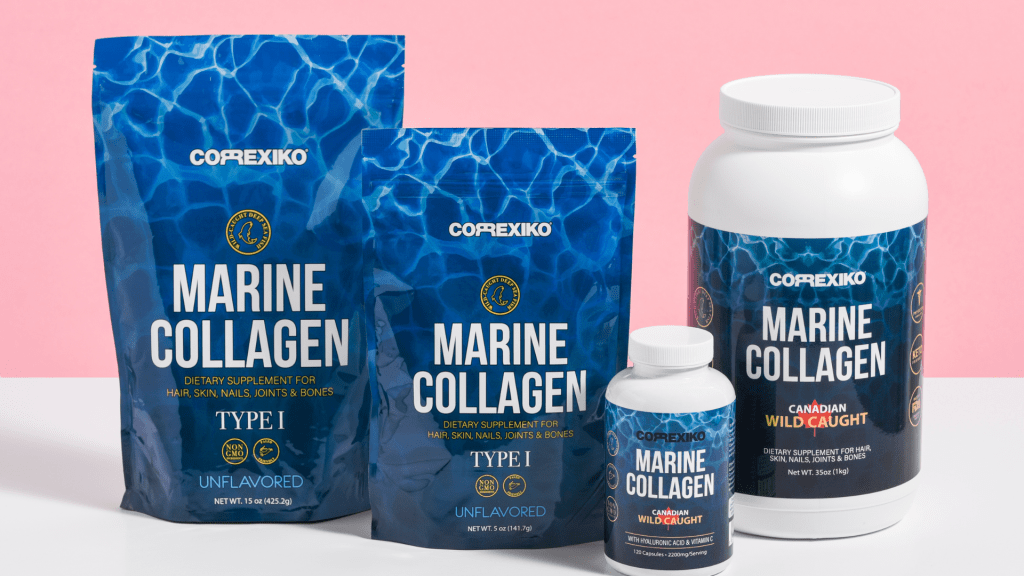 Гъвкавостта и потенциалните ползи от вътрешно решение?